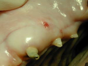 Fraktur der Milcheckzähne