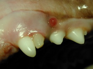 Milchzahnfrakur mit Fistel