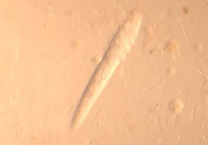 Milben, die Demodikose versuchen (Demotikosemilben)