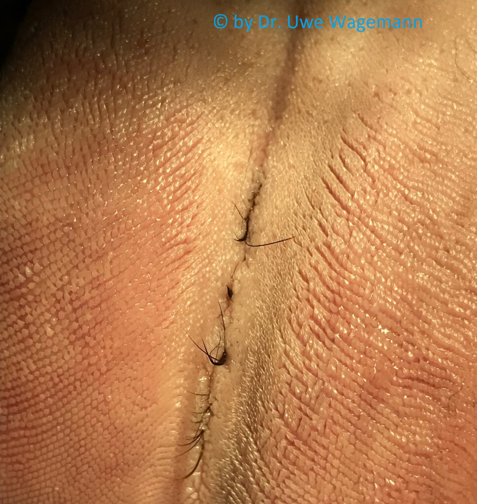 Haarige Zunge bei Hunden