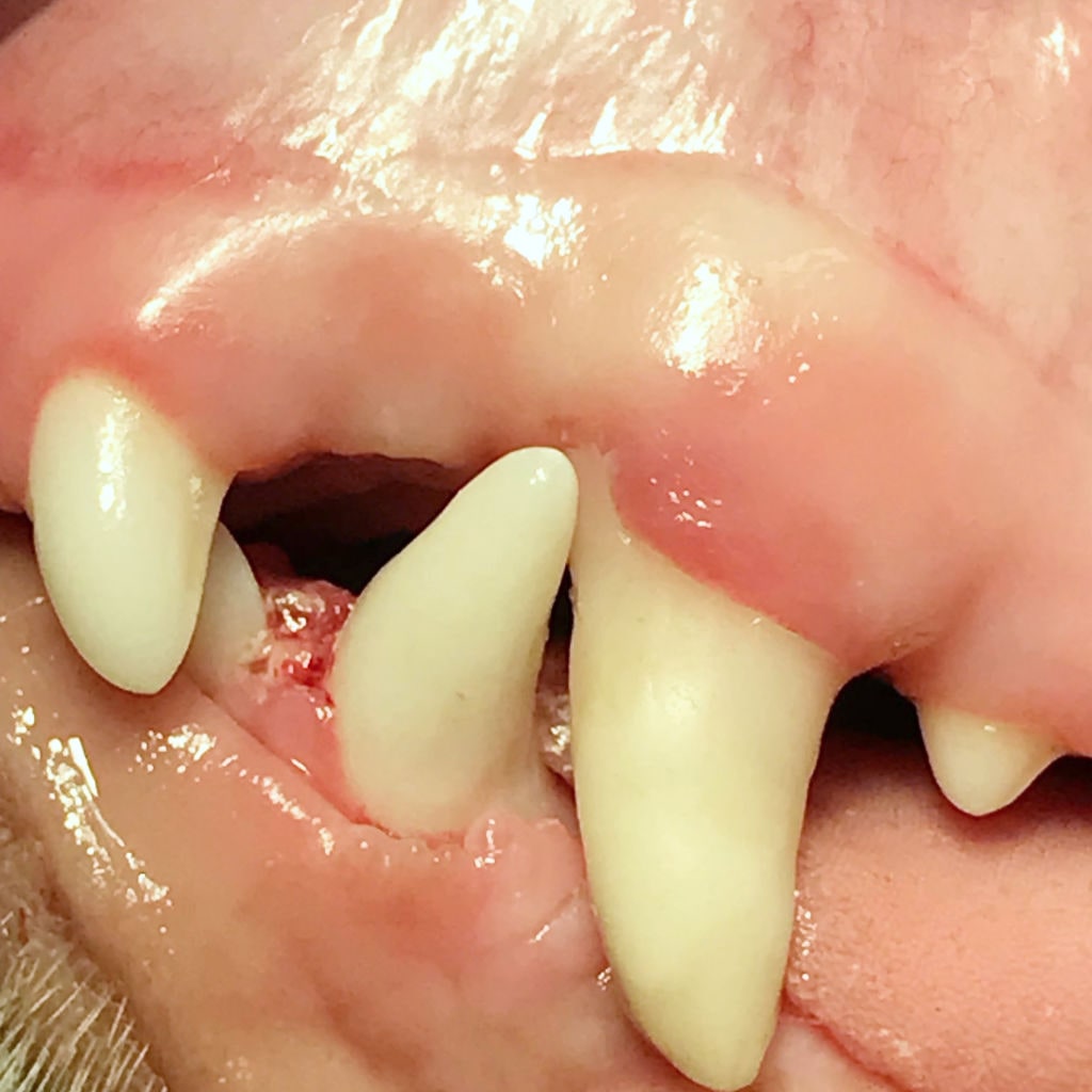 Füllungskunststoff in mehreren Schichten aufgebracht