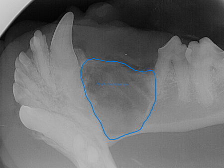 Ausgeräumte Zyste im Röntgenbild
